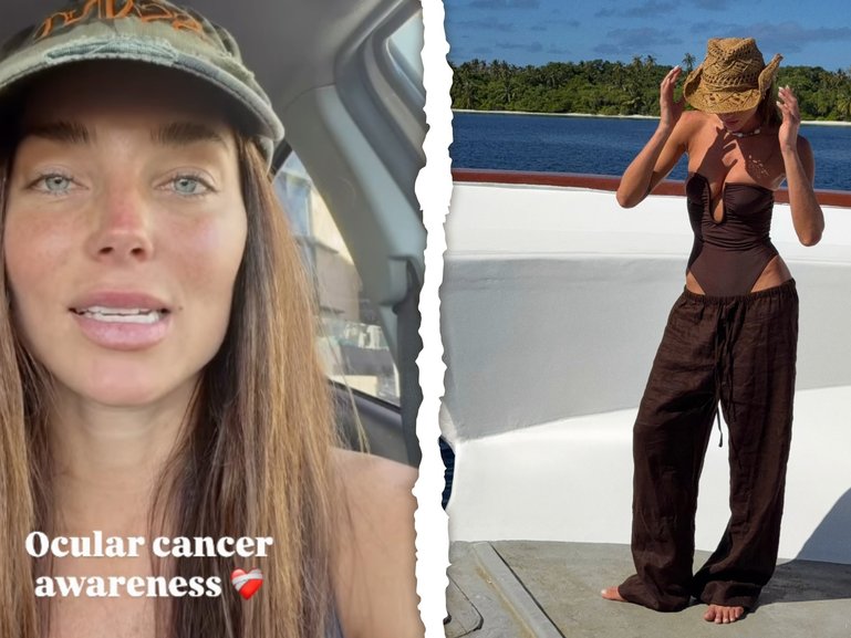 Gold Coast local Tilly Jac Smith revealed she had developed a rare form of eye cancer after she sought medical attention following a surf trip in the Maldives.