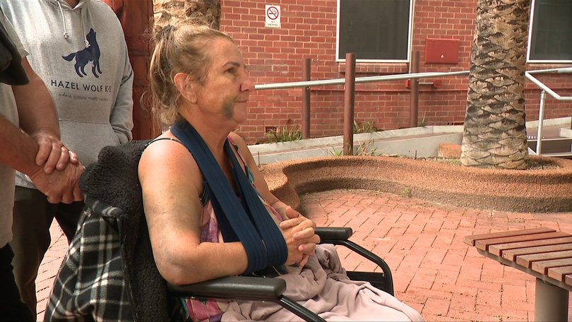 Julianne’s injuries include bruising to her head, broken ribs, sternum and shoulder, fractures to her feet and back and blood in her lungs.