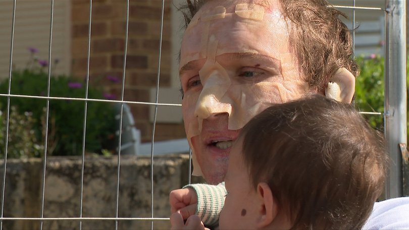 Justin Verduyn suffered burns after running back into a house fire in Ballajura, Perth.