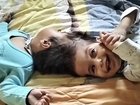 Heloisa and Helena Batista da Silva died after their fifth separation surgery.