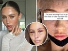 Aussie influencer Ruby Tuesday Matthews has undergone a Korean facelift in the hope of achieving a more “refreshed and awake” appearance.