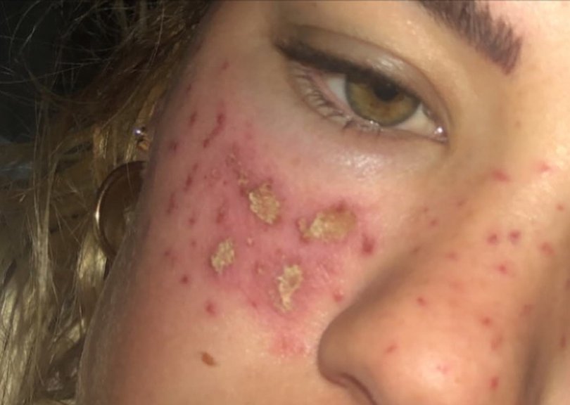 The TV personality says her face was left unrecognisable after she tried to replicate the Tik Tok trend at home.