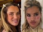 The mum-of-one revealed she was launching her own DIY freckle brand following a mishap years before that left her requiring urgent medical care.