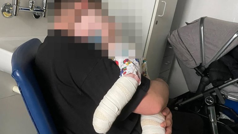 A nursery has been fined after a 10-month-old boy was badly burned by a bucket of boiled water containing bleach.