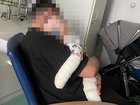 A nursery has been fined after a 10-month-old boy was badly burned by a bucket of boiled water containing bleach.