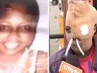 Maria Consuelo Cordoba needs two plastic tubes protruding from her nose to help her breathe and has only a small opening where her mouth once was after an acid attack.