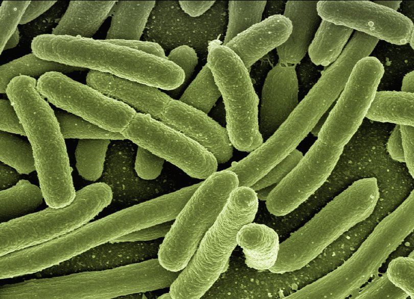 E. coli is a bacteria commonly found in faeces.