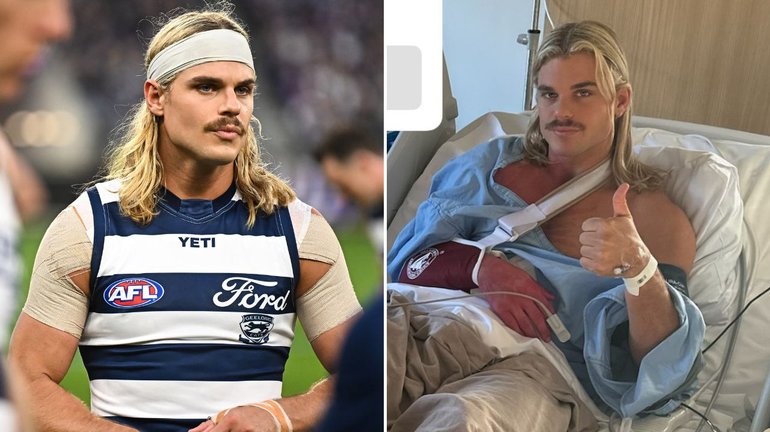 Bailey Smith has undergone surgery on his shoulder. 