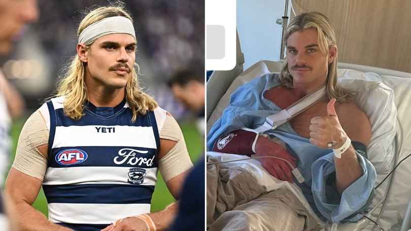 Bailey Smith has undergone surgery on his shoulder. 
