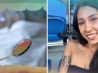 Emily Novo was treated in an emergency department for a painful abscess that left her unable to talk.