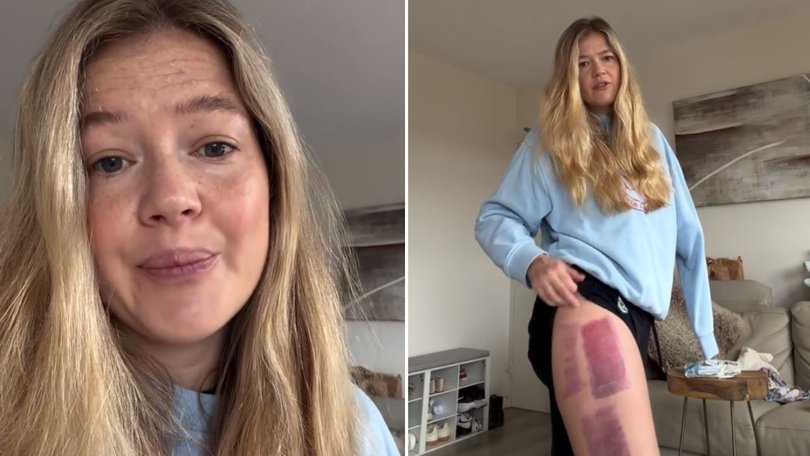 Coogee shark attack victim Leah Stewart has provided a sad update as she recovers from the injuries she suffered after escaping the jaws of a great white.