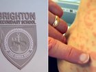 Four students have fallen ill with measles at Brighton Secondary School.