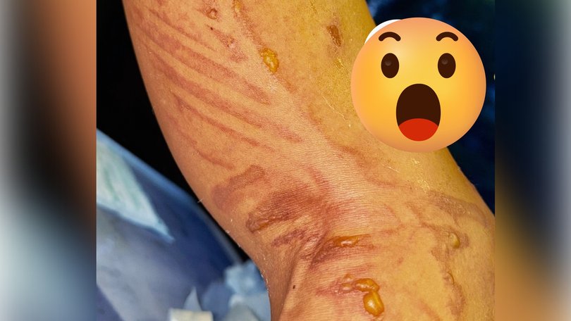 The pop star revealed the gruseome leg injury she suffered just hours before a major gig.