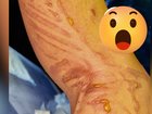 The pop star revealed the gruseome leg injury she suffered just hours before a major gig.