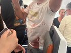 A bloodied Flydubai passenger on board the plane at the centre of the reported hijacking attempt.