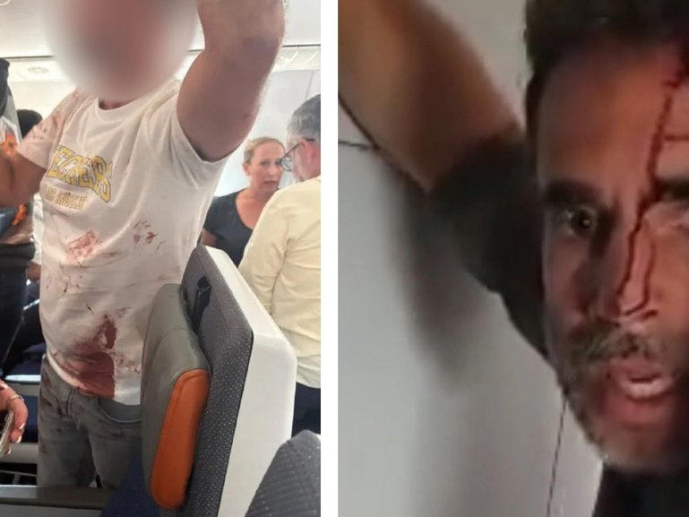 Images have emerged of bloody passengers involved in the mid-air struggle to bring down the knifewielding co-pilot on the Flydubai flight.