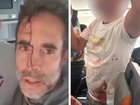 Images have emerged of bloody passengers involved in the mid-air struggle to bring down the knifewielding co-pilot on the Flydubai flight.