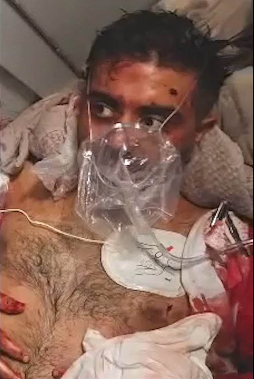 Captain Smit Machchhar was stabbed in the ordeal.