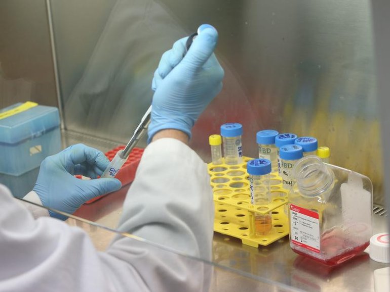 Australian biotechs say investment is at risk unless major changes are made to the capital gains tax reforms package.