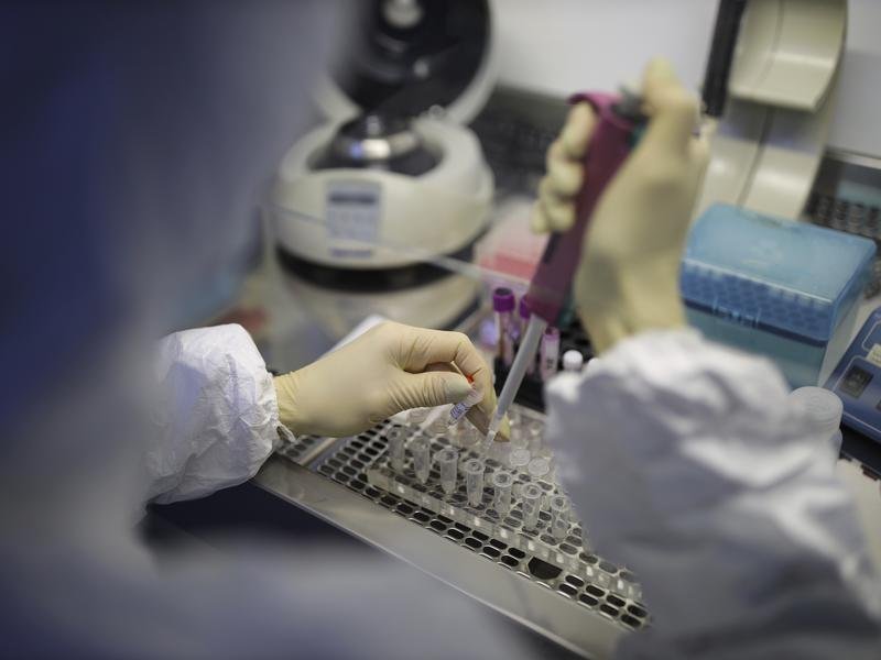 No one who was in contact with a Siberian lab worker has the plague, Russian health authorities say.