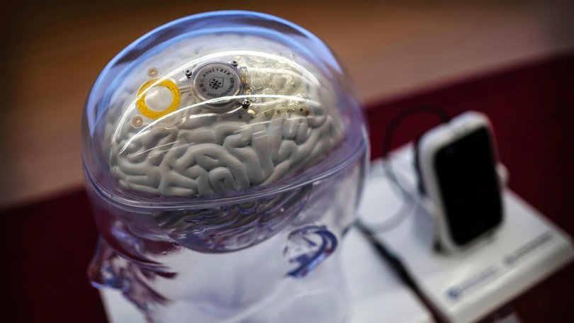 A semi-invasive brain-computer interface at the Chinese Institute for Brain Research in Beijing.
