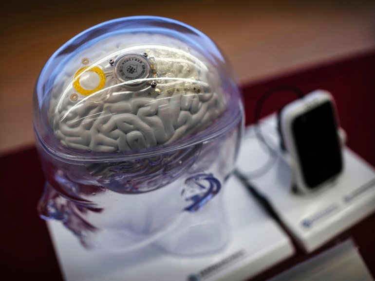 A semi-invasive brain-computer interface at the Chinese Institute for Brain Research in Beijing.