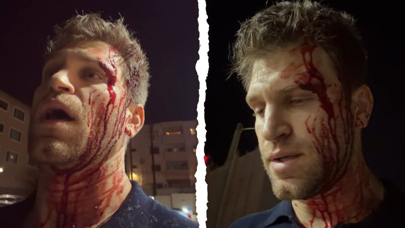 Actor Keegan Allen has described the frightening moment he was violently robbed by two masked attackers in West Hollywood.