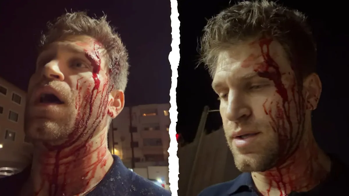Keegan Allen: Pretty Little Liars actor shares bloody video after allegedly being robbed by armed attackers Keegan Allen: Pretty Little Liars actor shares bloody video after allegedly being robbed by armed attackers