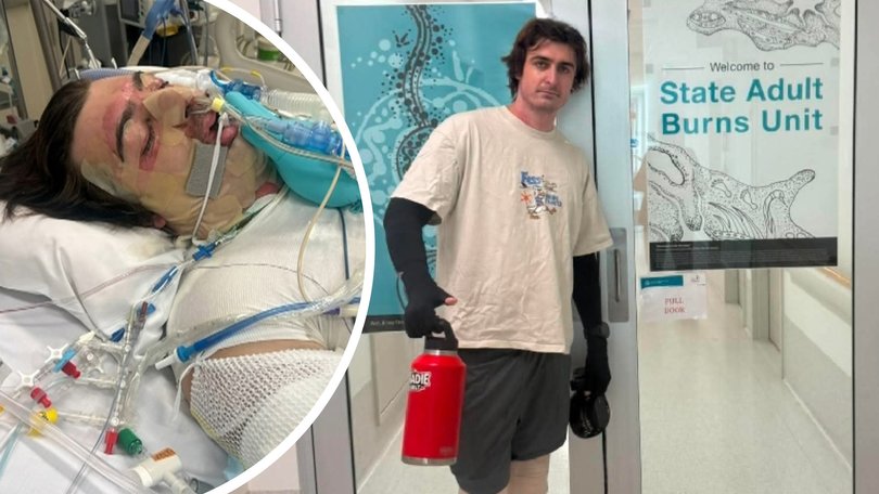 The 25-year-old has been discharged from hospital after eight weeks, but still has a long road ahead.