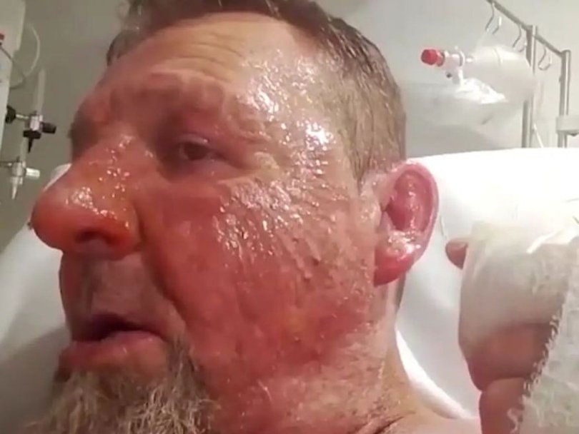 54-year-old Randovan Banic was allegedly set alight at Prince of Wales Hospital. 