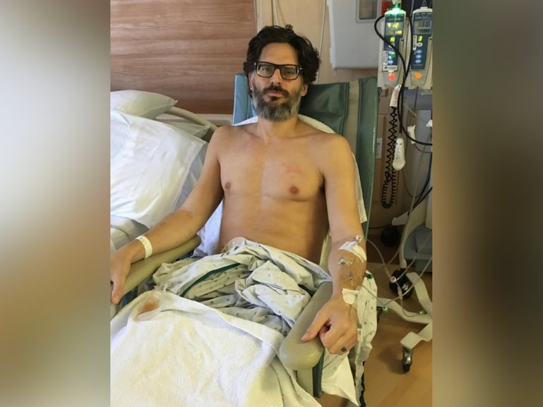 Actor Joe Manganiello has shared graphic images documenting his ongoing health battle as he continues to recover from a mystery illness.