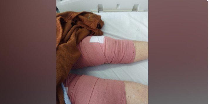 Ms Ravenscroft suffered horrific injuries to both her legs.