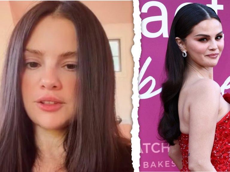 Selena Gomez has opened up about the negative effects her vaping addiction has had on her voice.