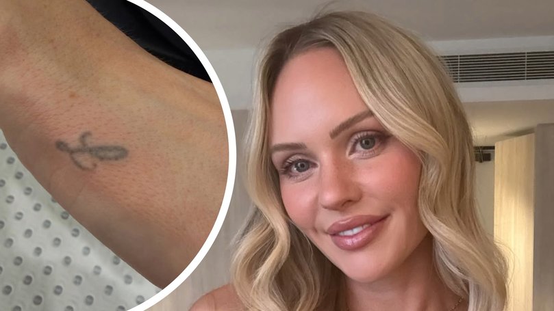 Jules Neale was filmed getting her tattoo honouring ex-partner Lachie removed.