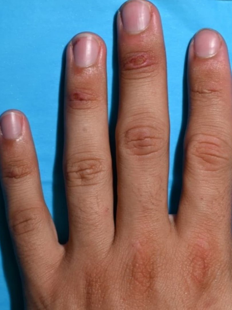 The jury was told several cuts, abrasions and scrapes were found on the former police officer’s hands. Picture: NewsWire Handout